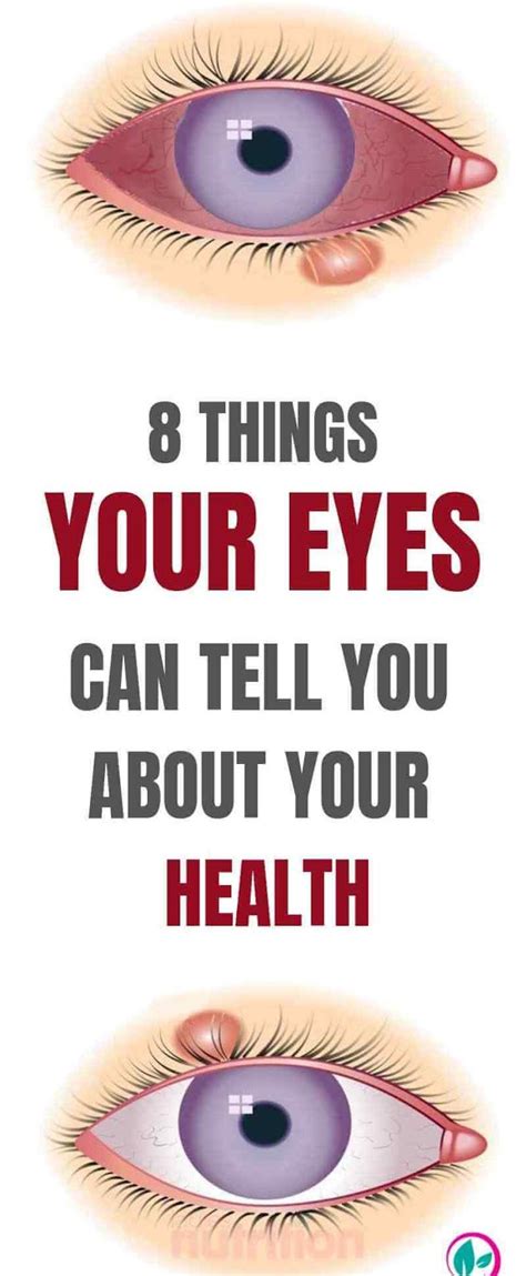 8 Things Your Eyes Can Tell You About Your Health