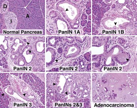 Pancreatic Duct Histology