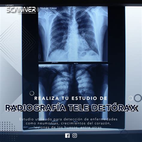 Radiografía Digital Lázaro Scanner Diagnóstico Por Imagen