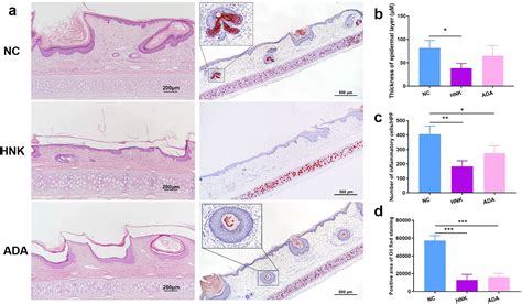 Honokiol Improves Acne Like Lesions In A Rabbit Ear Model By