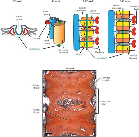 The Human Spinal Disc: Relevant Anatomy and Physiology | Neupsy Key