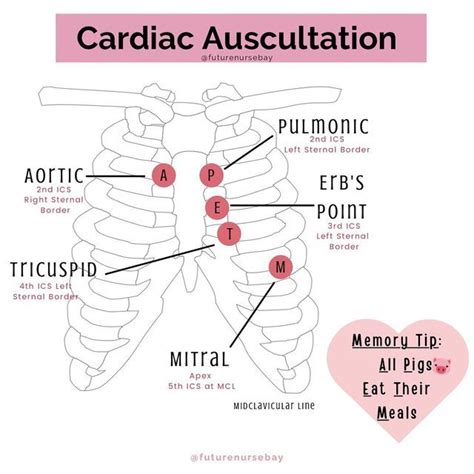 Understanding Cardiac Auscultation