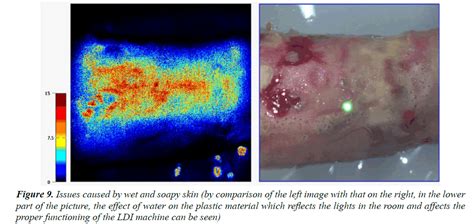 Tissue perfusion assessment of paediatri | Biomedical Research