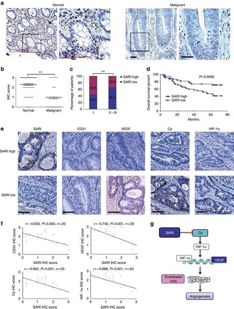 Validation Of Sari In Human Colon Cancer Tissue Microarray A