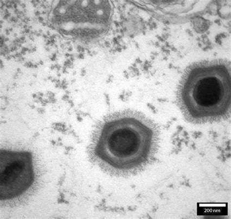 Acanthamoeba Polyphaga Mimivirus Delong America