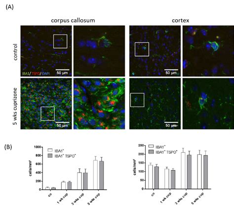 Co Localization Of TSPO With The Microglia Monocyte Marker IBA1 A