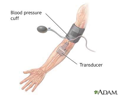 Duplex ultrasound - UF Health