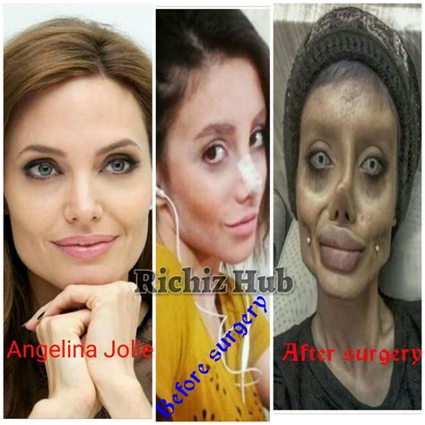 Sahar Tabar Undergoes 50 Surgeries To Look Like Angelina Jolie Photos