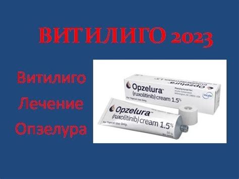 Витилиго. Опзелура - новый крем для лечения витилиго. - YouTube
