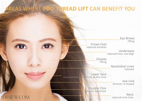 What You Need To Know About Pdo Thread Lift Non Surgical Skin