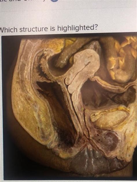 Solved Which Structure Is Highlighted O Kidney O Internal Chegg