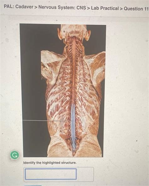 Solved Pal Cadaver Nervous System Cns Lab Practical Chegg