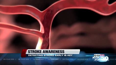 Knowing How To Recognize A Stroke Could Save Your Life