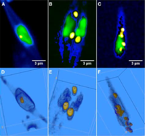 Lipid Accumulation And Characteristic Lipid Droplet Morphology Of Algae