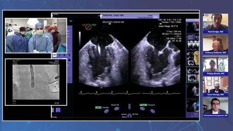 LIVE CASE #12 Emerging Non-TEER TMVr Devices and TMVR | tctmd.com