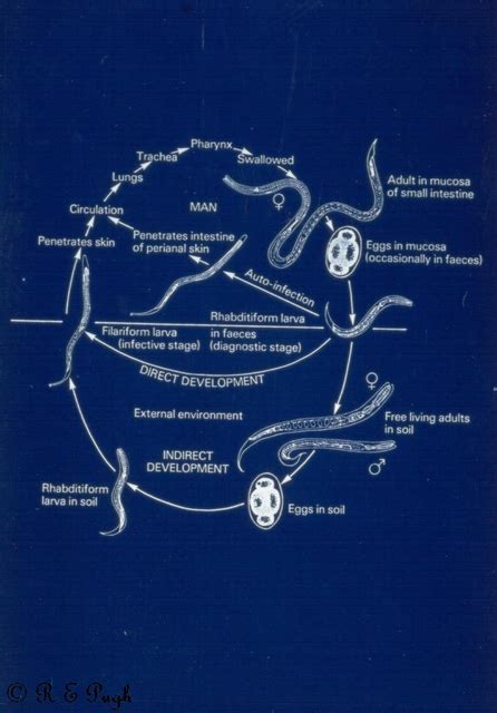 Strongyloides Stercoralis Epidemiology 02