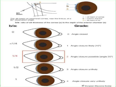 Anatomy of anterior chamber angle (1)