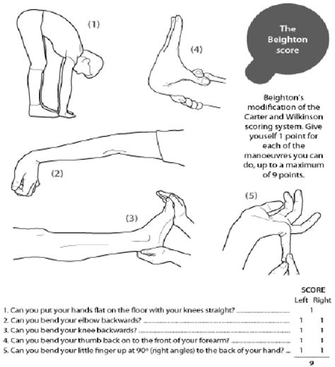 Epidemiology Of Generalized Joint Laxity Hypermobility In Fourteen