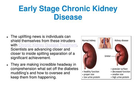 PPT - Medicines for Early Stage Chronic Kidney Disease PowerPoint