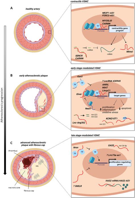 Long Non Coding RNAs At The Crossroad Of Vascular Smooth Muscle Cell