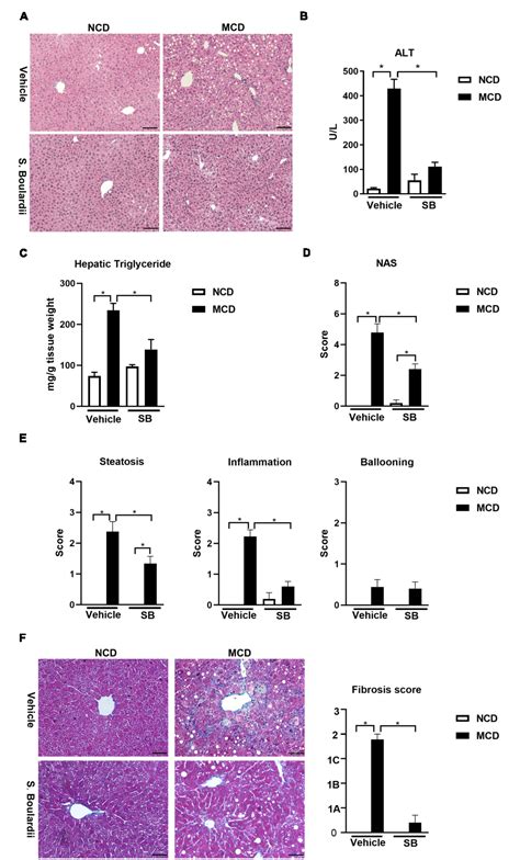 Figure From Saccharomyces Boulardii Ameliorates Non Alcoholic