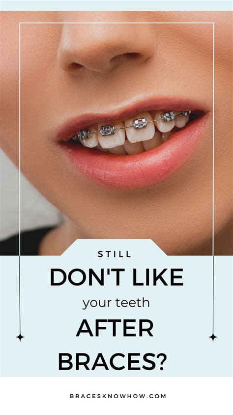 Feeling disappointed after your braces came off? You're not alone. If you still don't like your ...