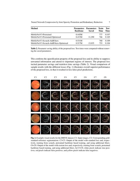 Neural Network Compression By Joint Sparsity Promotion And Redundancy