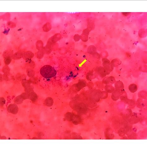 A The Colonies Of Histoplasma Capsulatum On Columbia Blood Agar