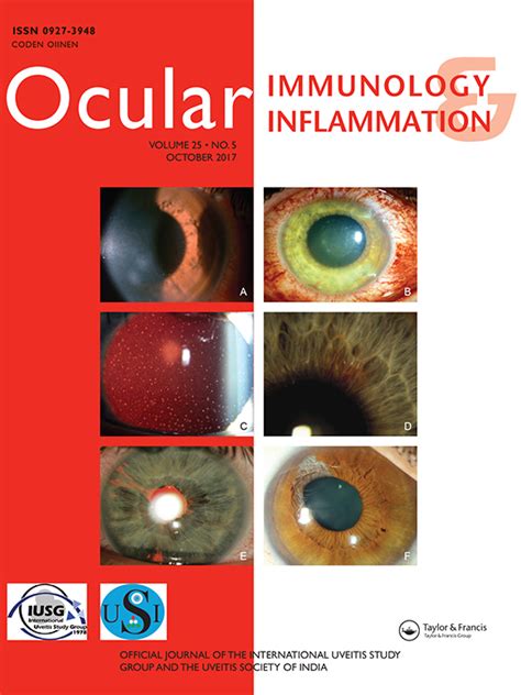 Anterior Uveitis Sarcoidosis