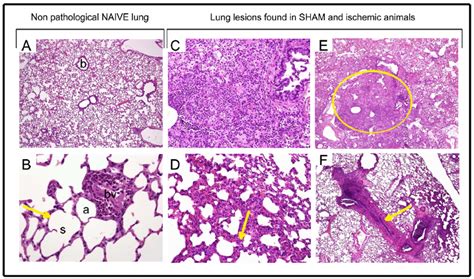 Histology Of Lung Labeled