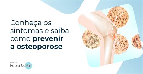 Conheça os sintomas e saiba como prevenir a osteoporose Clínica Dr