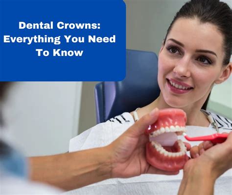 Dental Crowns Everything You Need To Know The Team Dental