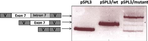 Minigene analysis of the c.763 G>A change in the PCCB gene. The gel ... 