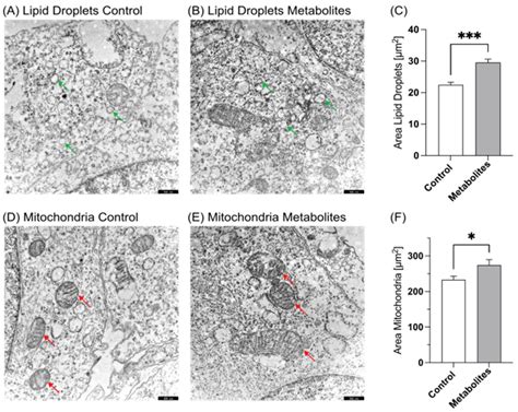 Transmission electron microscopy of SH-SY5Y wild-type cells. (A ...