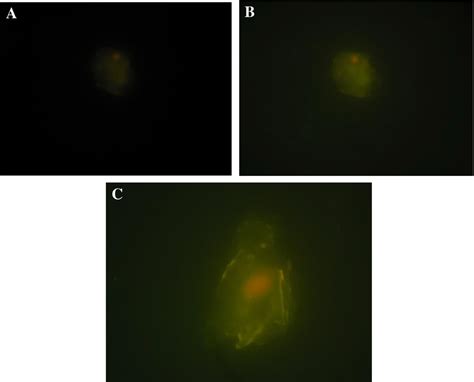 Fluorescent Microscope Image Of Apoptotic Mcf 7 Cells That Were Treated