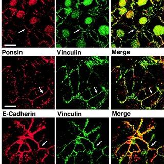 Catenindependent Colocalization Of Nectin And L Afadin With