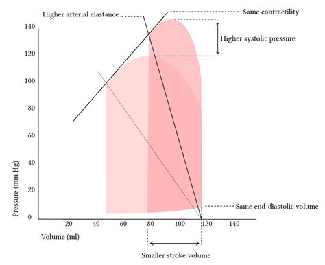 Ventricular Pressure Volume Loops Deranged Physiology