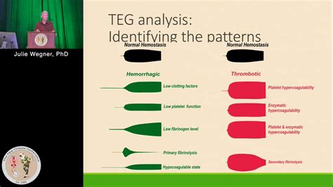 TEG Cheat Sheet