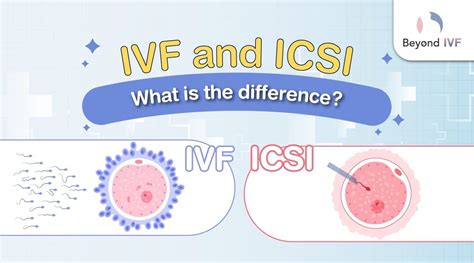 Ivf And Icsi What Is The Difference