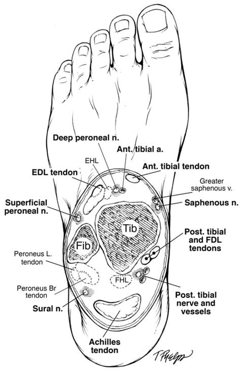 Ankle Block