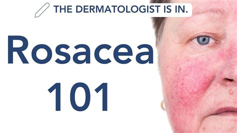 Rosacea Explained What Rosacea Is And The Best Ways To Treat It