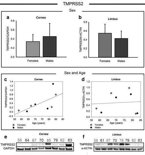 Western Blot Analysis Of Tmprss2 In Corneal And Limbal Tissues From Download Scientific Diagram