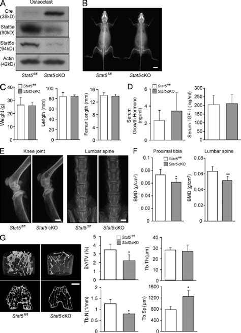 Stat Cko Mice Exhibit Decreased Bone Mass A Expression Of Cre