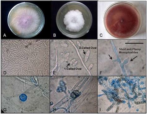 Fusarium Morphology In Identification And Characterisation