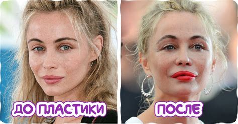 16 звезд, которые сделали модные бьюти-процедуры, а теперь жалеют об ...
