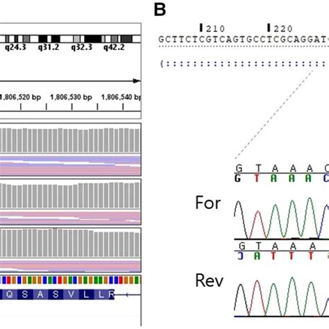 Whole Genome Sequencing A And Sanger Sequencing B Validation Of The