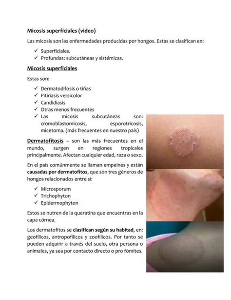 Micosis cutánea Laury uDocz