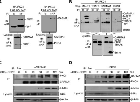 Figure 1 From Protein Kinase C Delta Negatively Regulates T Cell