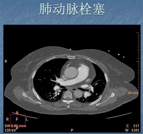 影像科危急值 值班必备，夜班不求人 Medscicn