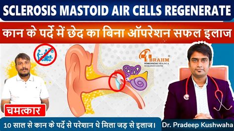 Mastoid Air Cells Sclerosis Treatment Kan Ke Parde Me Ched Ka Ilaj In